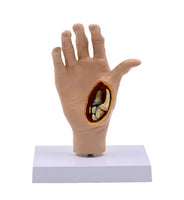 Modelo de Mano patologia tendon y ligamento osteoartritis