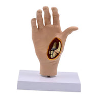 Modelo de Mano patologia tendon y ligamento osteoartritis