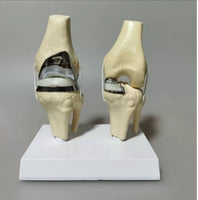 Modelo de Rodilla - menisco ligamento cartílago desmontable