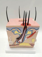 Modelo de caspa cuero cabelludo