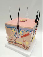 Modelo de caspa cuero cabelludo