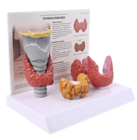 Patologia de tiroides