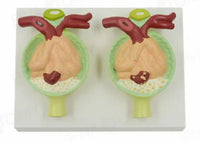 modelo de proteína en orina proteinura sistema urinario glomerular