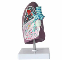 Modelo anatómico de pulmón de fumador patologias