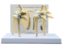 Modelo anatomico degeneracion de hombro osteoartritis