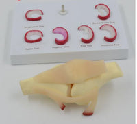 Modelo Anatomico de rodilla - meniscos traumatologia