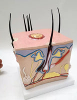 Modelo de caspa cuero cabelludo