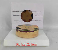 Modelo cancer de piel carcinoma