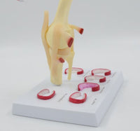 Modelo Anatomico de rodilla - meniscos traumatologia