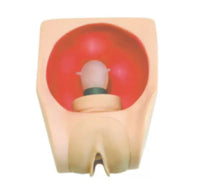 Simulador de Colocacion Dispositivo Anticonceptivo Diu utero uterino