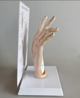 Modelo de Mano patologia tendon y ligamento osteoartritis