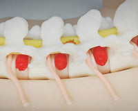 Simulador de espalda columna en tecnologia HD endoscópica UBE cirugía endoscopica lumbar