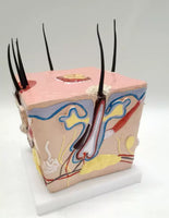 Modelo de caspa cuero cabelludo