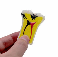 Modelo de Caries Modelo de Descomposición de Caries