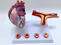 Modelo de corazon trombosis Vascular con arteria