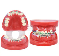 Modelo de implantes dentales