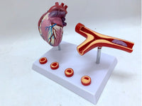 Modelo de corazon trombosis Vascular con arteria
