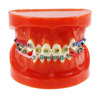 Modelo de implantes dentales