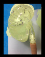 Simulador de Urología urinario riñones ureteroscopio avanzado
Simulador de entrenamiento de laparoscopia, modelo de entrenamiento de endoscopia Urología.