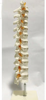 Modelo de discos vertebrales Columna Dorsal