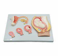 Modelo de desarrollo fetal Fertilización Formación de cigoto e implantación uterina Útero femenino Ovario