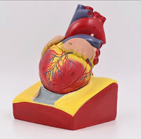 Modelo de corazón humano desmontable - tamaño real