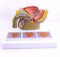 Modelo patológico de Prostata masculino