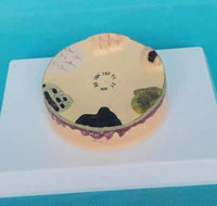 Modelo cancer de piel carcinoma