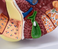 modelo anatomico Higado patologico detallado
