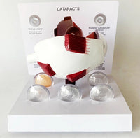Modelo Anatomico Cataratas