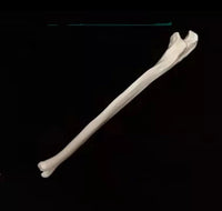 Anatomia de huesos femur tibia perone hueso