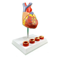 Modelo de anatomía del corazón humano con trombosis