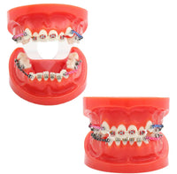 Modelo de implantes dentales