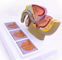 Modelo patológico de Prostata masculino