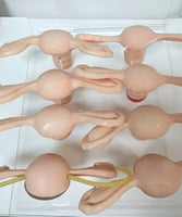 Modelo de lesion uterina uterina de cervix