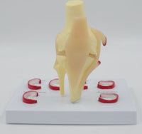 Modelo Anatomico de rodilla - meniscos traumatologia
