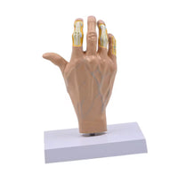 Modelo de Mano patologia tendon y ligamento osteoartritis