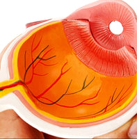 Modelo Anatomico Cataratas