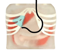 Simulador de Ultrasonido endoscopio endoscopia