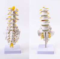 Modelo anatomico de columna vertebral humana con hernia discal