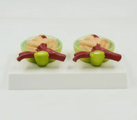 modelo de proteína en orina proteinura sistema urinario glomerular