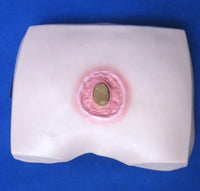 Evolucion de ulcera de presión simulador enfermeria