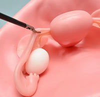 Simulador Uterino histeroscopia utero endoscopia