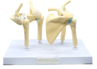 Modelo anatomico degeneracion de hombro osteoartritis