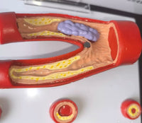 Modelo Arteriosclerosis arterias