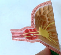 Modelo de estomago reflujo gastrico Patologia gastrica