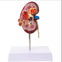 Modelo anatómico de riñón