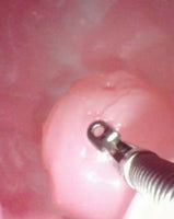 Simulador duodenal endoscopia estomago duodeno gastro