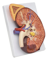 Modelo de Riñón maxizado con Glándula renal rinon