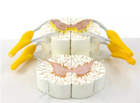 Modelo Medula Nervio Cordon Espinal